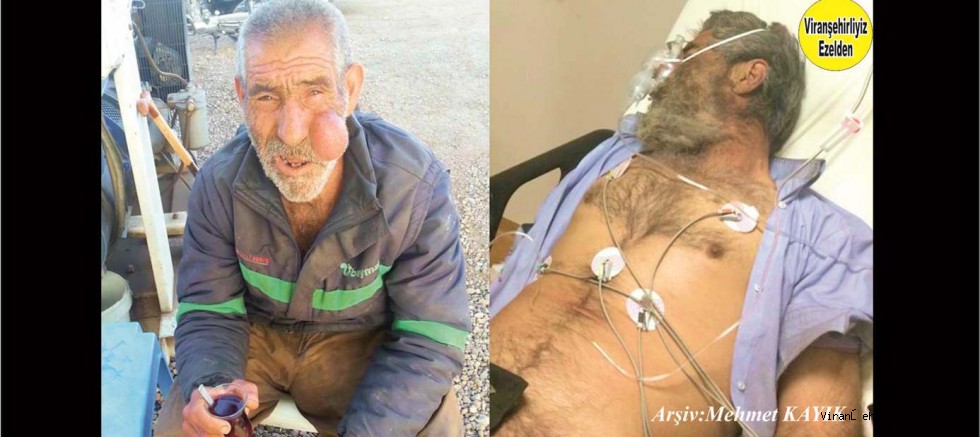 Viranşehir’de Sevilen Zararsız İnsan Merhum Sabri Kürek(Sabro)